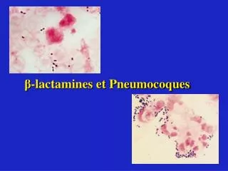 ? -lactamines et Pneumocoques