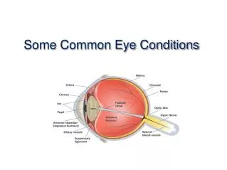 Some Common Eye Conditions