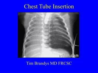 Chest Tube Insertion