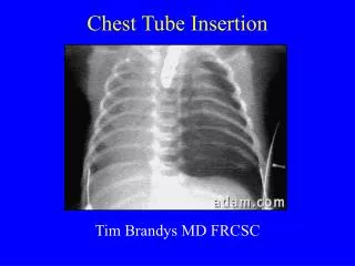 chest tube insertion