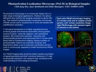 Photoactivation Localization Microscopy (PALM) in Biological Samples