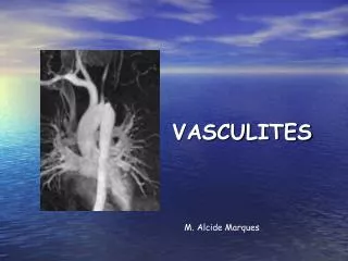 vasculites