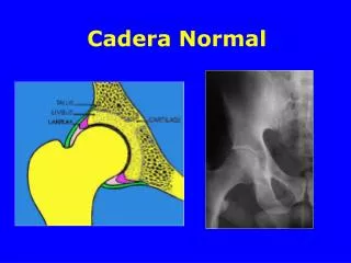 Cadera Normal