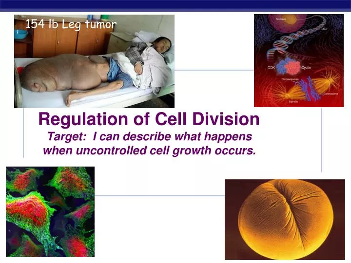 regulation of cell division target i can describe what happens when uncontrolled cell growth occurs