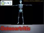 Osteoartritis - slide 1
