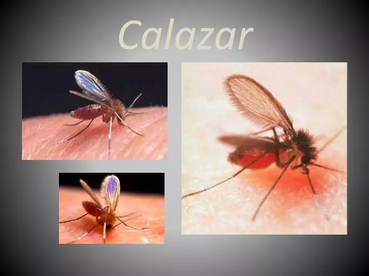 calazar