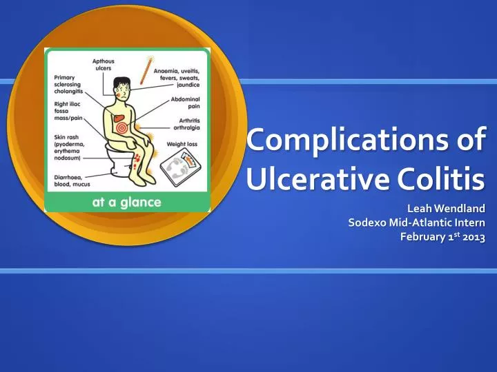 complications of ulcerative colitis