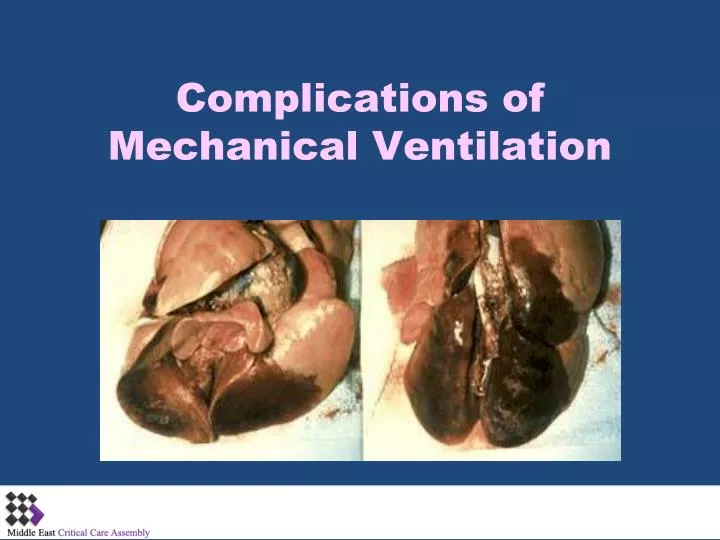 complications of mechanical ventilation