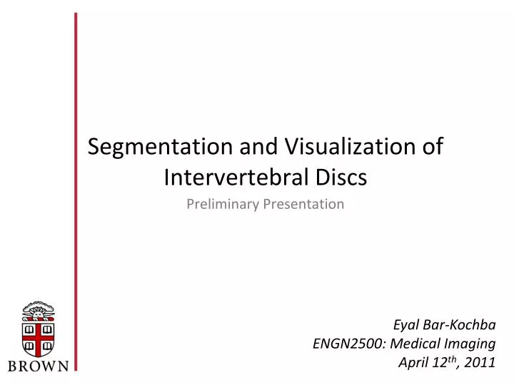 segmentation and visualization of intervertebral discs