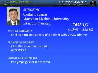 TYPE OF SURGERY: Cochlear implant surgery of a patient with VLA Syndrome PLANNED SURGERY: