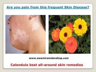 Are you pain from this frequent Skin Disease
