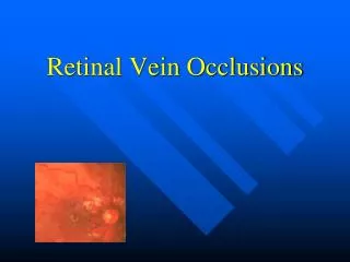 Retinal Vein Occlusions