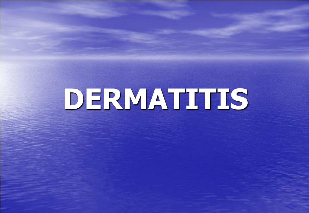 PPT - DERMATITIS PowerPoint Presentation, free download - ID:3778496
