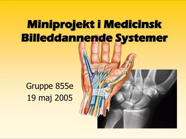 miniprojekt i medicinsk billeddannende systemer