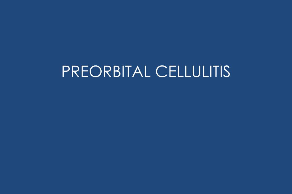 PPT - PREORBITAL CELLULITIS PowerPoint Presentation, free download - ID ...