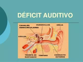 d ficit auditivo
