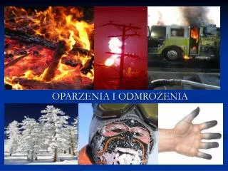 oparzenia i odmro enia