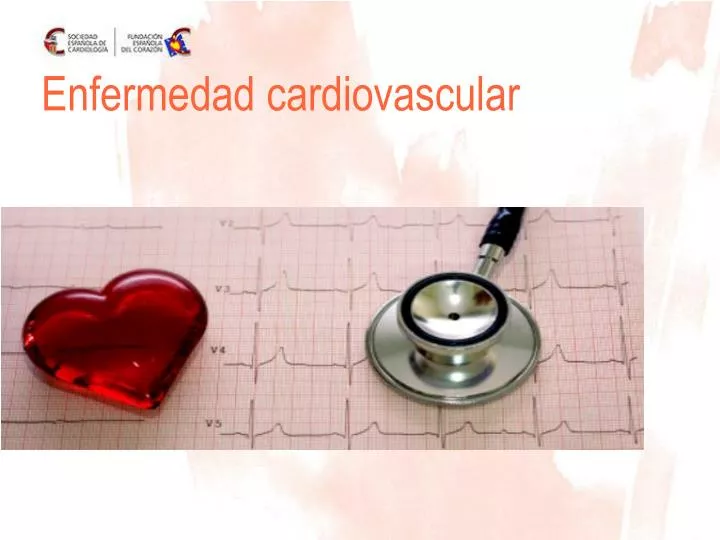 enfermedad cardiovascular