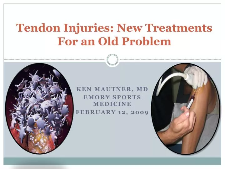 tendon injuries new treatments for an old problem