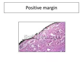 Positive margin