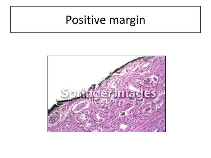 positive margin