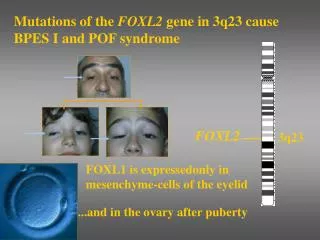 FOXL1 is expressedonly in mesenchyme-cells of the eyelid