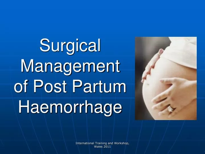 surgical management of post partum haemorrhage