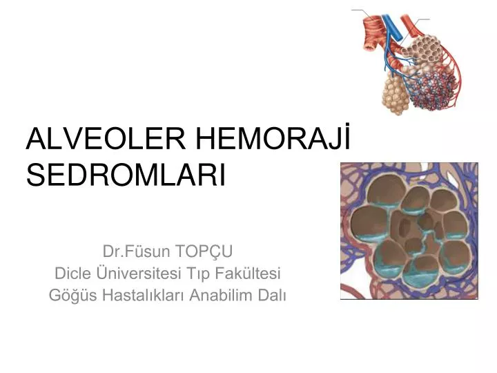 alveoler hemoraj sedromlari