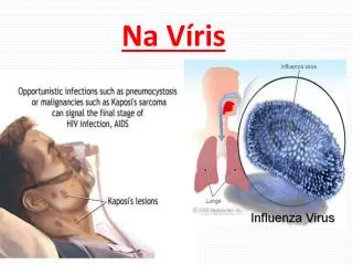 na v ris
