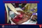 Traumatologia cardio- vascolare - slide 1