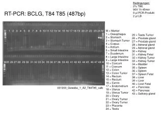 RT-PCR: BCLG, T84 T85 (487bp)