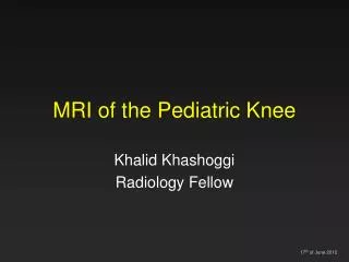 MRI of the Pediatric Knee