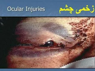 ocular injuries