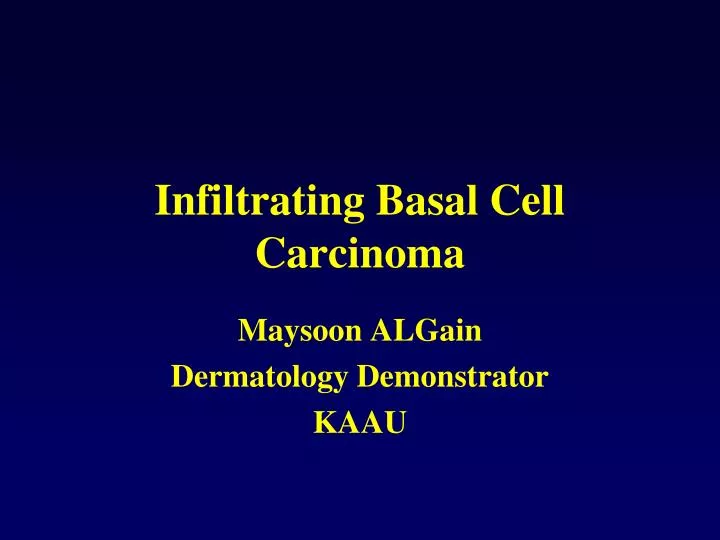 infiltrating basal cell carcinoma
