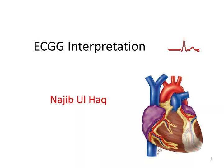ecgg interpretation
