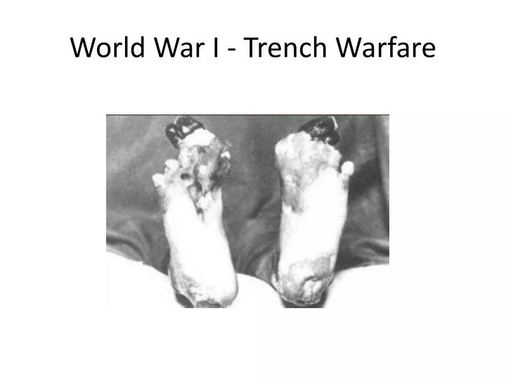world war i trench warfare