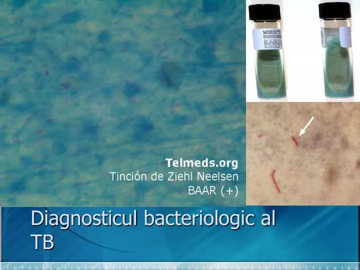 diagnosticul bacteriologic al tb