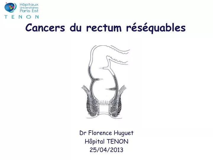 cancers du rectum r s quables