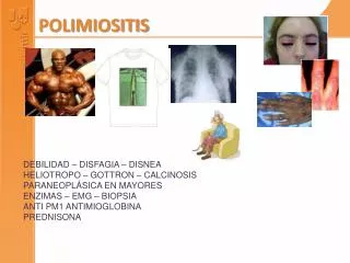 polimiositis