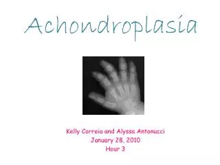 Achondroplasia