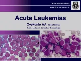 Acute Leukemias