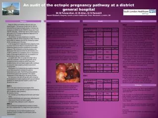 An audit of the ectopic pregnancy pathway at a district general hospital