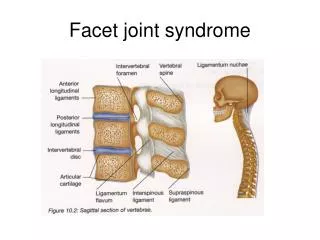 facet joint syndrome