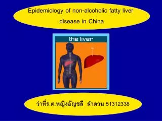 Epidemiology of non-alcoholic fatty liver disease in China