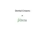 Dental Crowns Procedures at Dentzz Dental