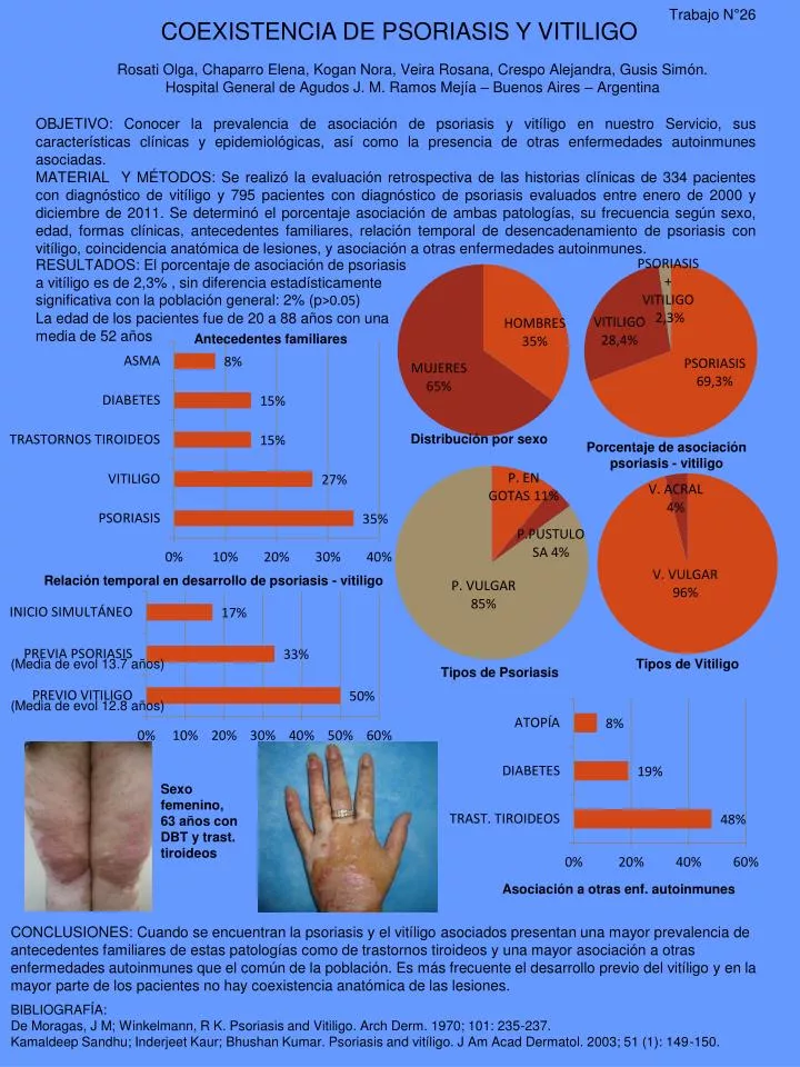 coexistencia de psoriasis y vitiligo