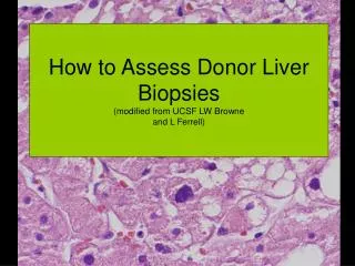 How to Assess Donor Liver Biopsies (modified from UCSF LW Browne and L Ferrell)