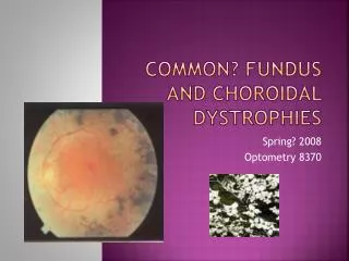 Common? fUndus and Choroidal Dystrophies
