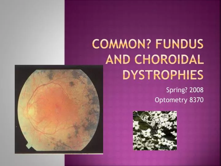 common fundus and choroidal dystrophies