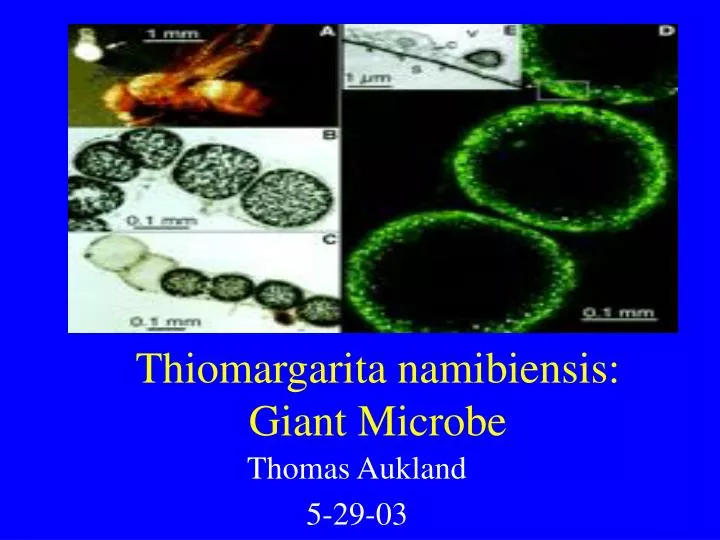 thiomargarita namibiensis giant microbe